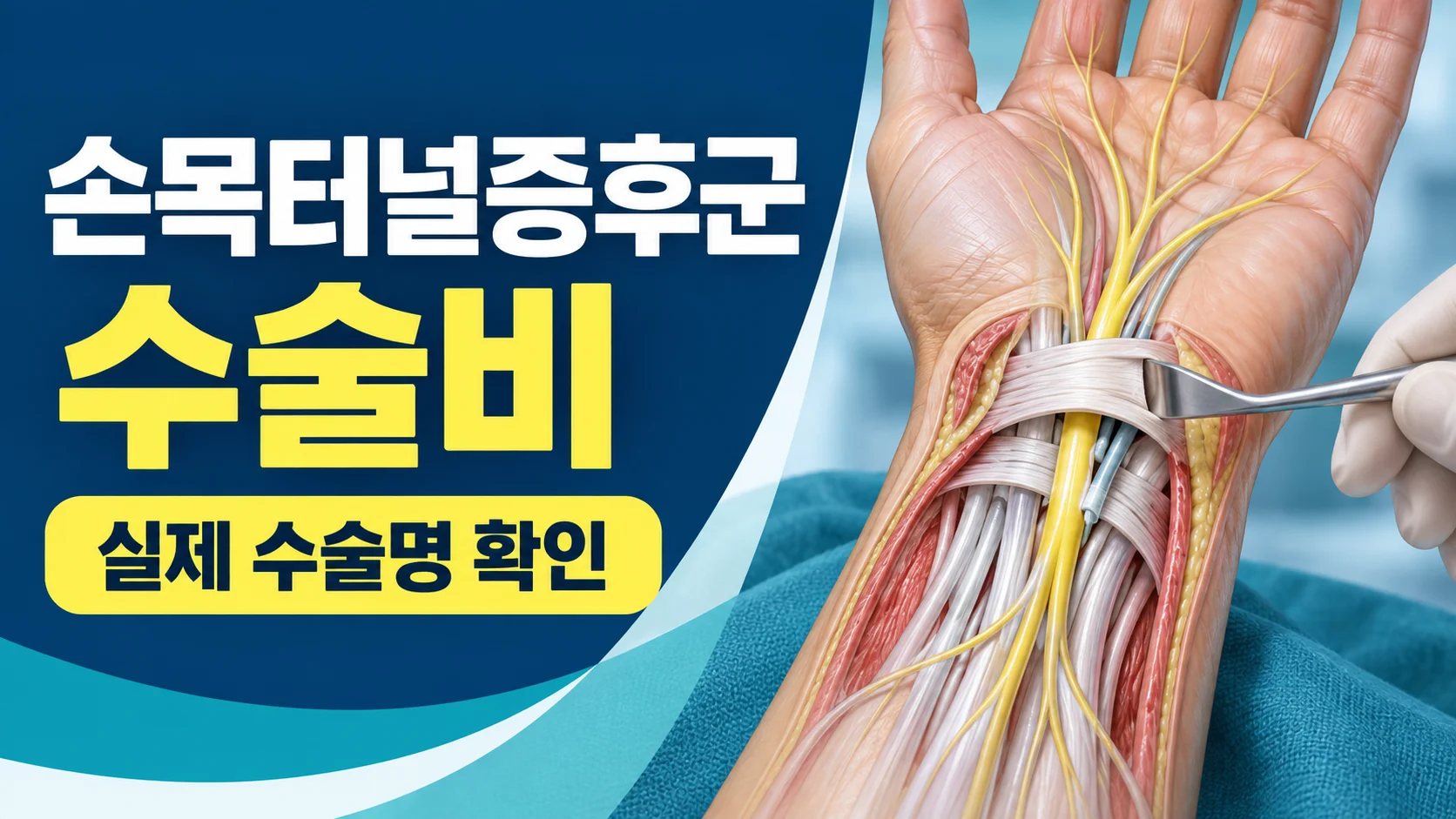 손목터널증후군 수술비와 실제 수술명 확인 카드뉴스