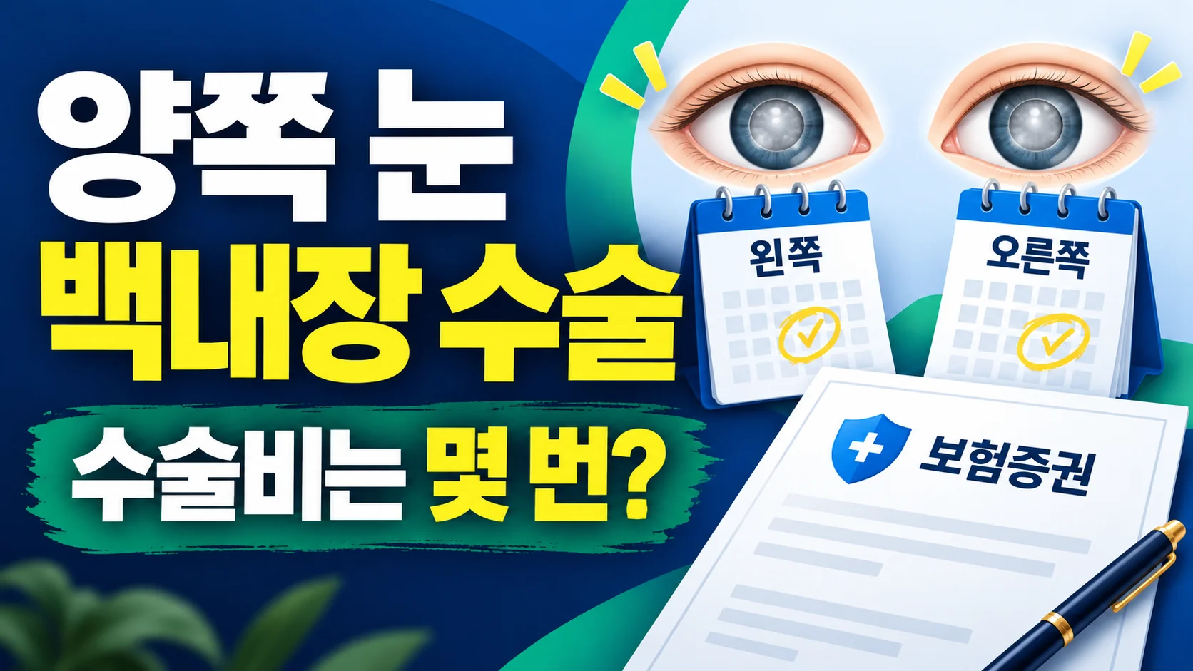 양쪽 눈 백내장 수술비 횟수 카드뉴스