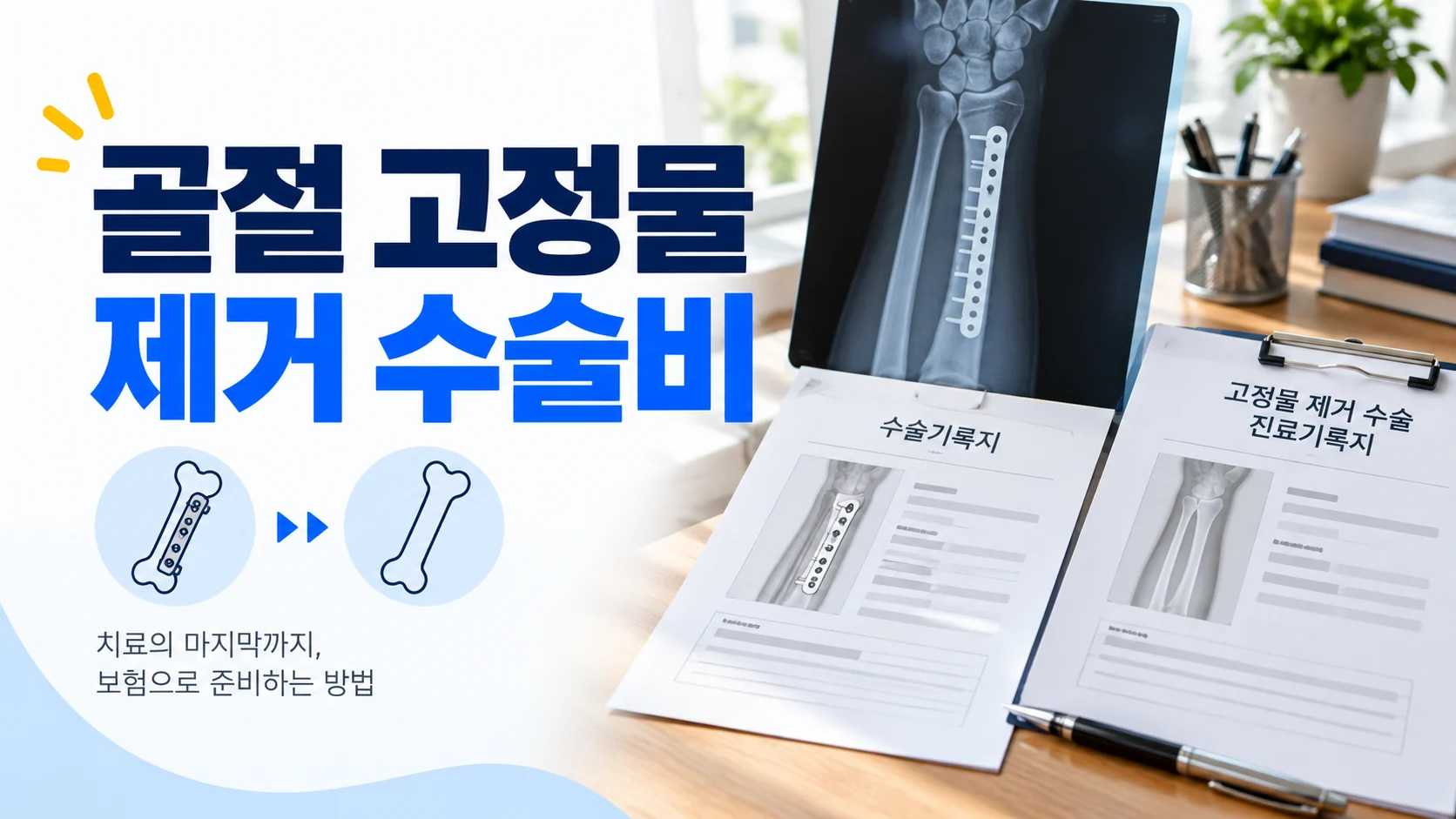 골절 고정물 제거 수술비 확인법 카드뉴스