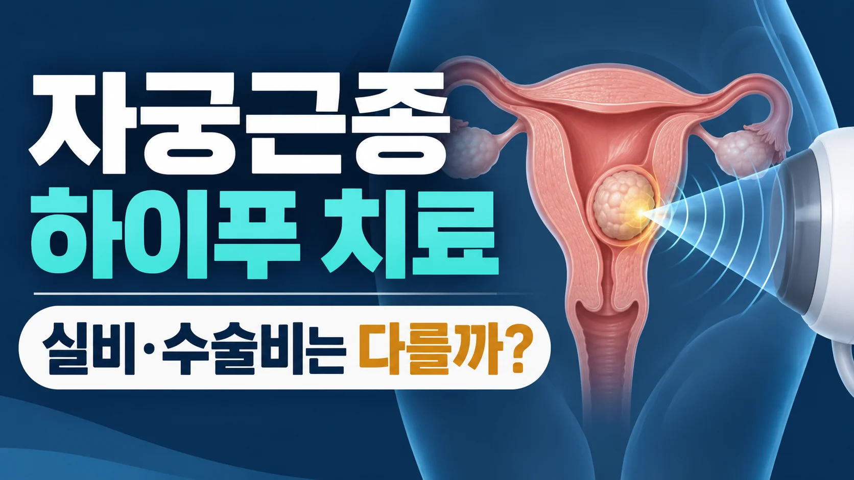 자궁근종 하이푸 치료의 실비와 수술비 특약 차이 카드뉴스