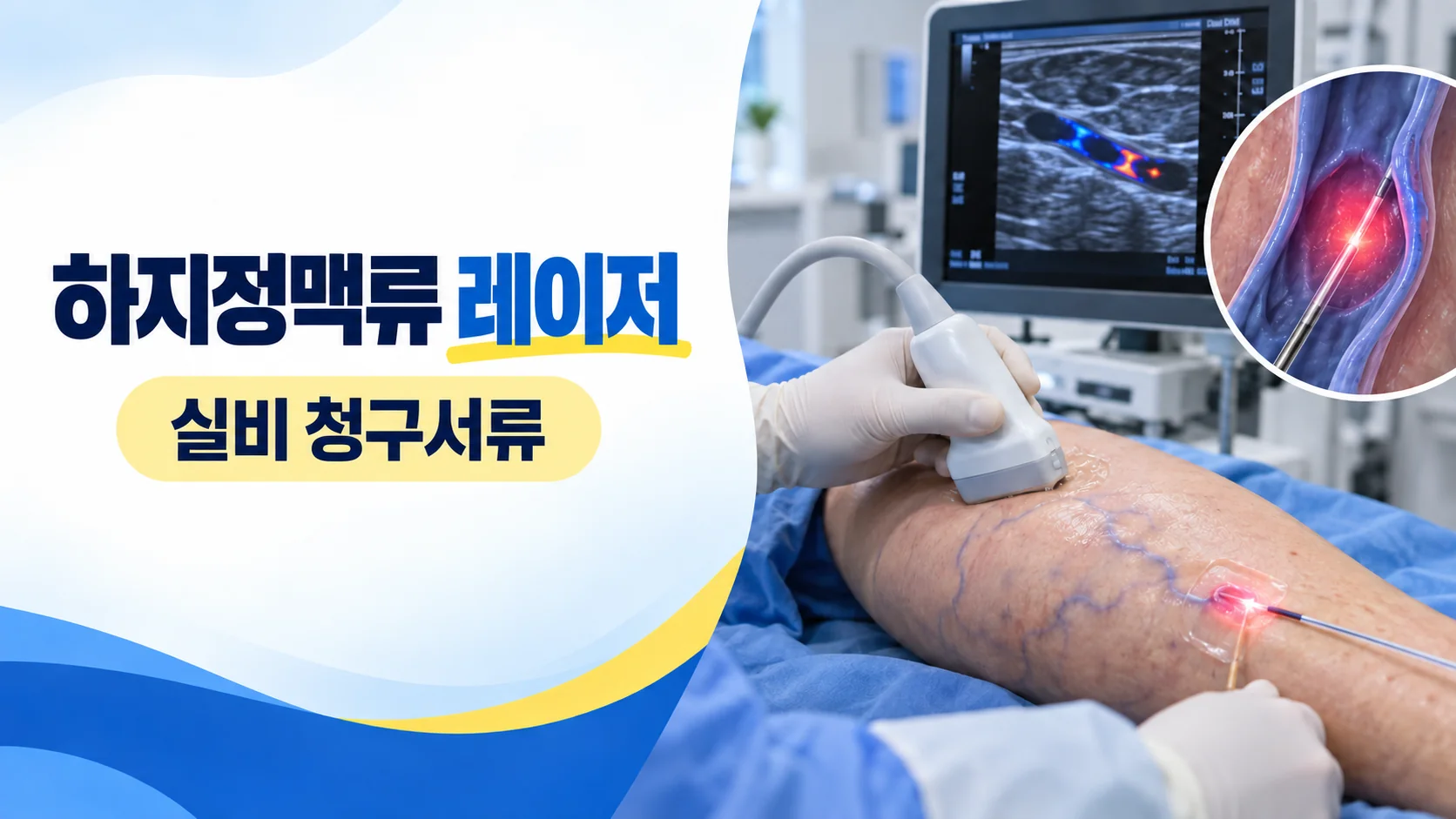 하지정맥류 레이저 수술 실비 카드뉴스