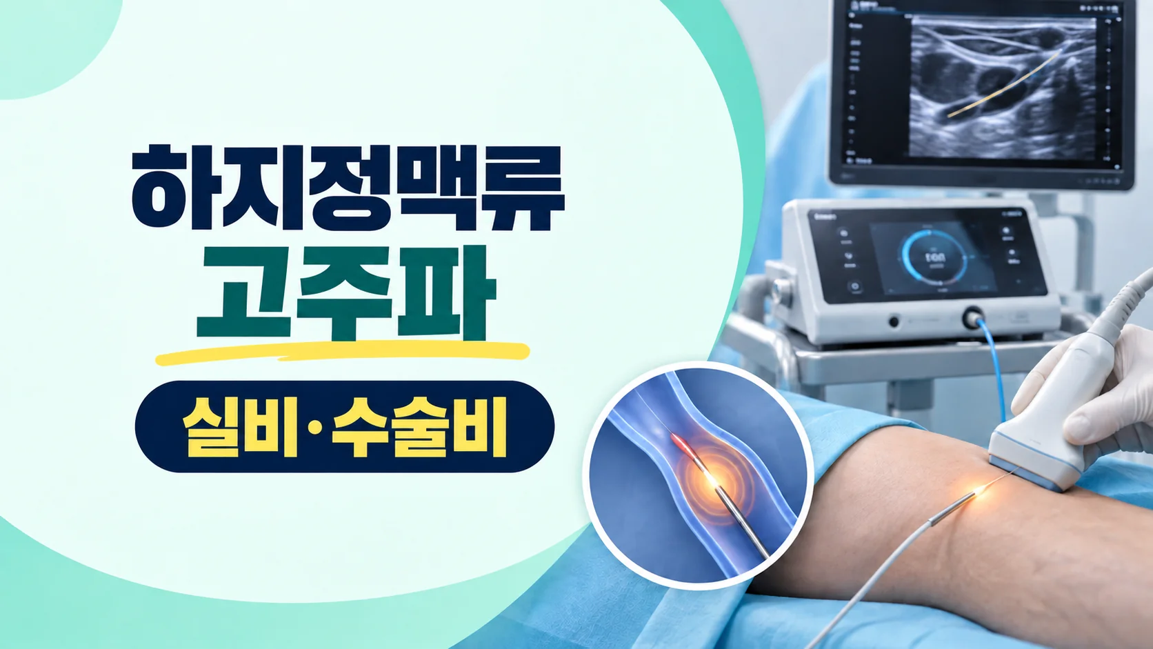 하지정맥류 고주파 수술 실비 카드뉴스